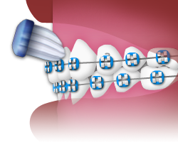 Brushing - Step 2