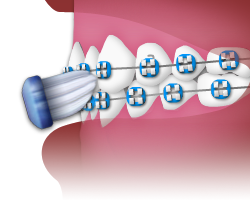 Brushing - Step 3